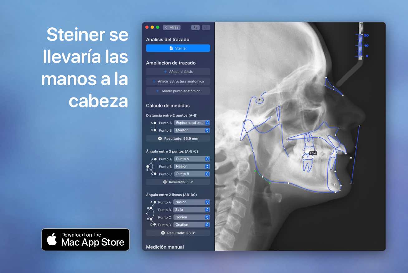 Steiner ceph in orthokit